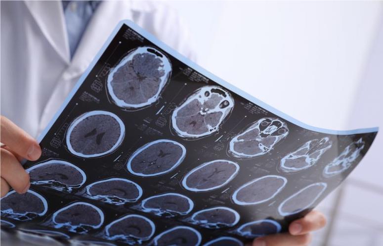 Компютърна томография