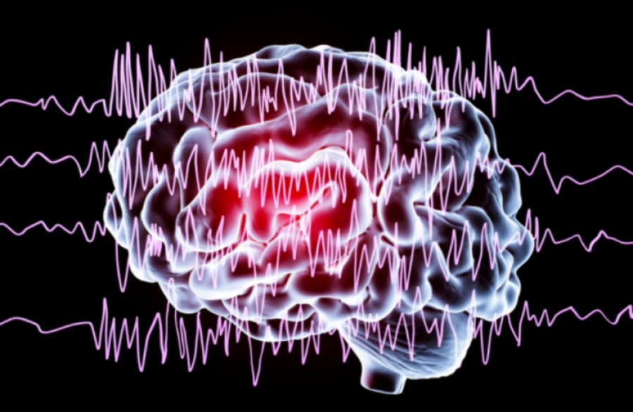 Електроенцефалография
