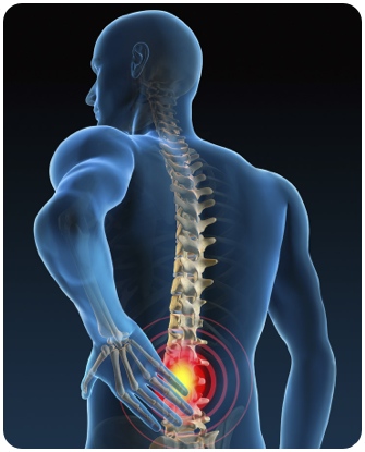 Дискова херния