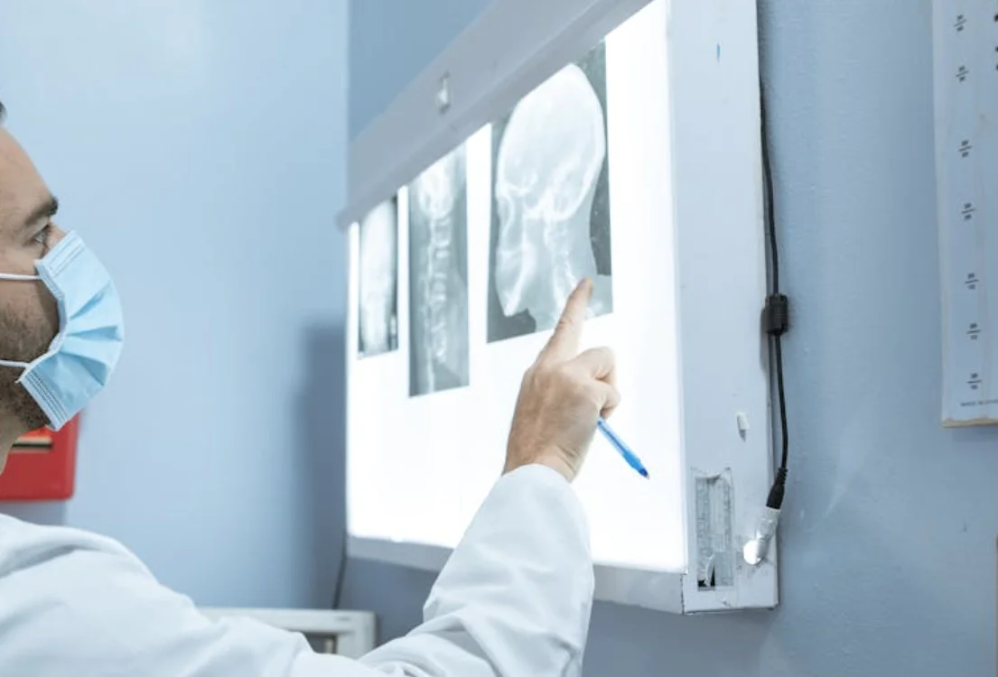 Неврит на лицевия нерв