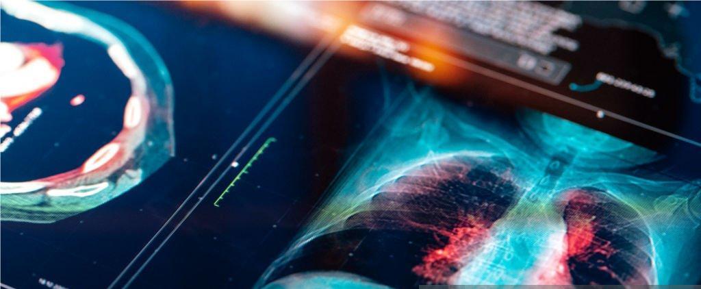 Дигитална рентгенография