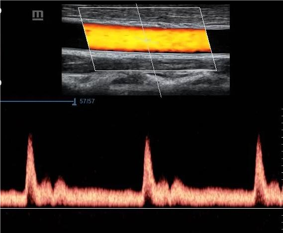 Ултразвукова диагностика